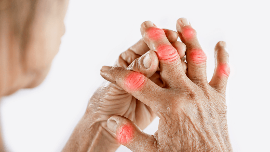 Arthritis: Its Debilitating and Detrimental Effects - Velobiotics 
